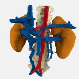 Impressió 3D aplicada a la medicina