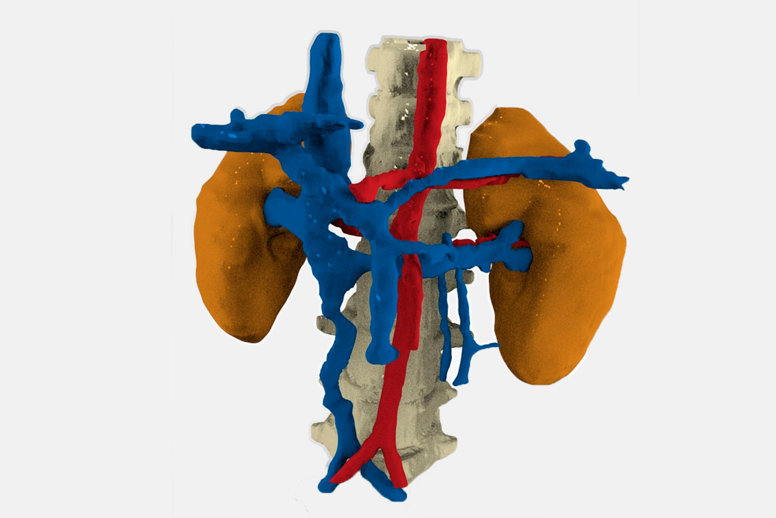 Impresión 3D aplicada a la medicina